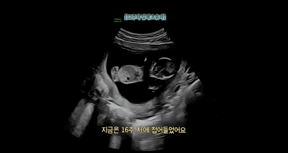 '영호♥와 재혼' 28기 옥순, 둘째 임신 발표…