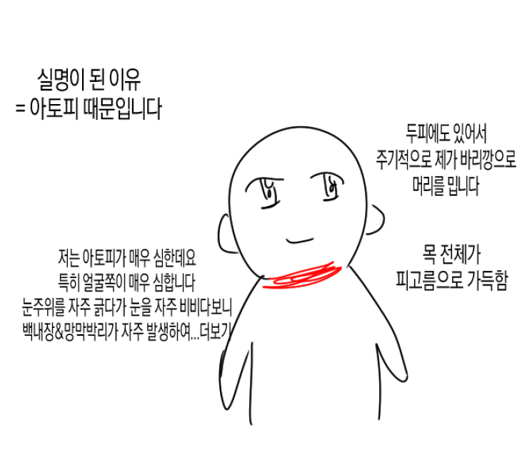 (충격) 아토피가 𝙅𝙊𝙉𝙉𝘼 힘든 이유..JPG