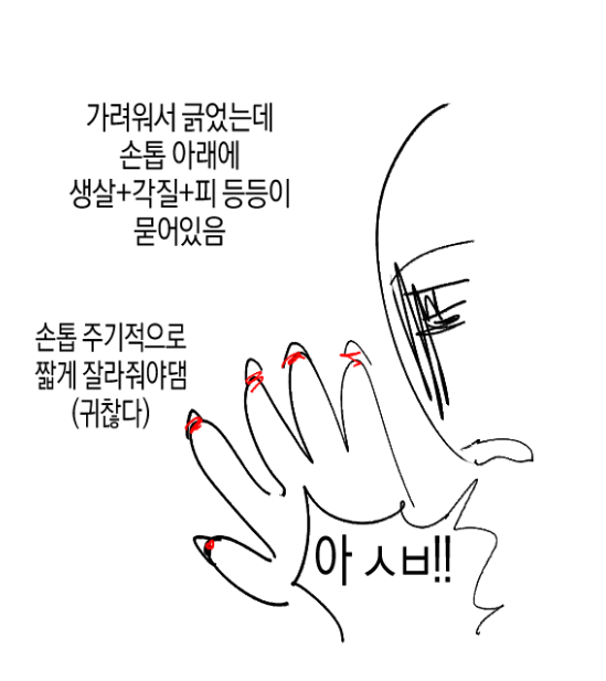 (충격) 아토피가 𝙅𝙊𝙉𝙉𝘼 힘든 이유..JPG