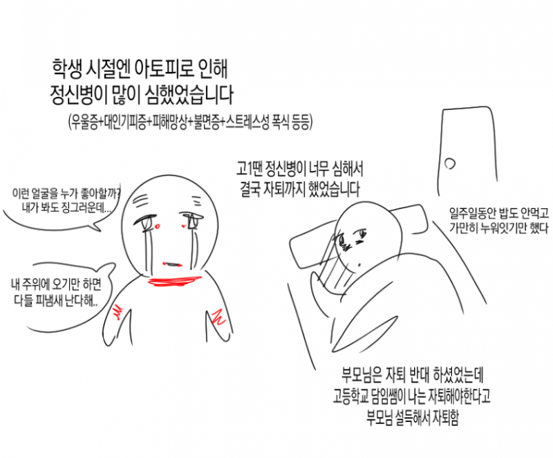 (충격) 아토피가 𝙅𝙊𝙉𝙉𝘼 힘든 이유..JPG
