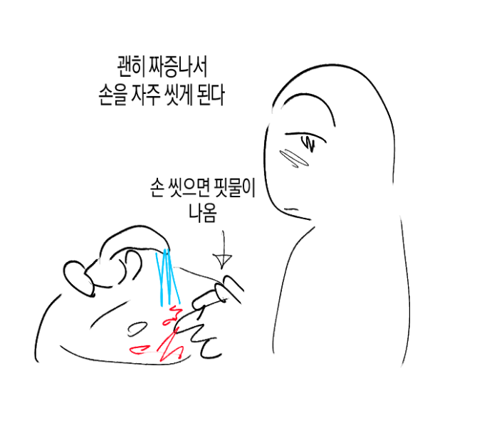 (충격) 아토피가 𝙅𝙊𝙉𝙉𝘼 힘든 이유..JPG
