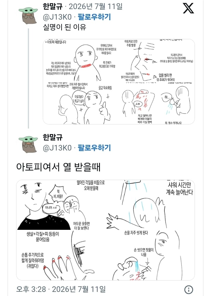 아토피가 정말 힘든 이유…