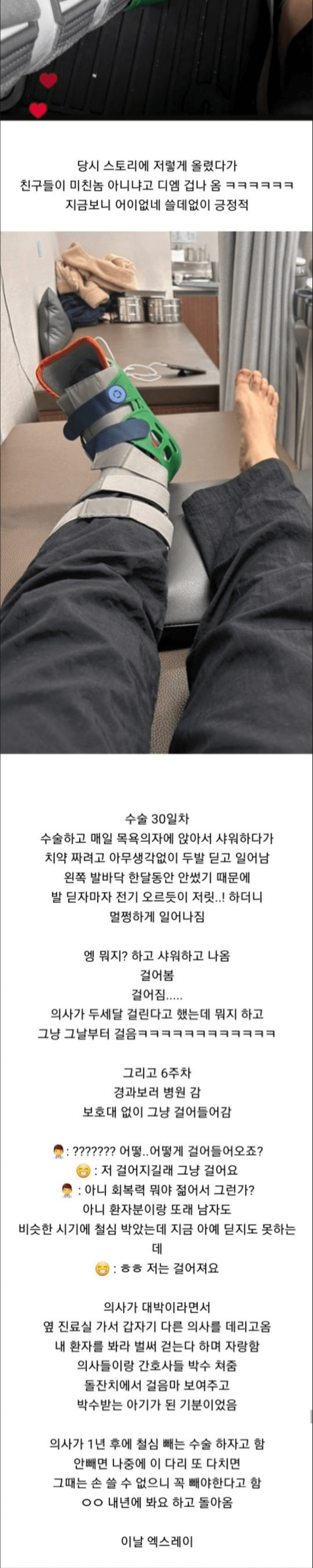 스압 발목 부러졌는데 안아프다는 관우녀