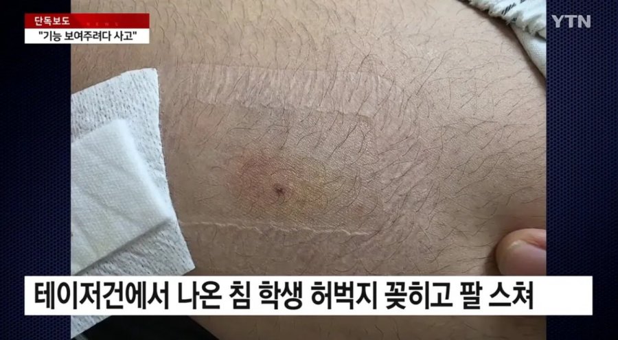 채널a) 경찰, 테이저건 보여주다 오발..중학생 다쳐