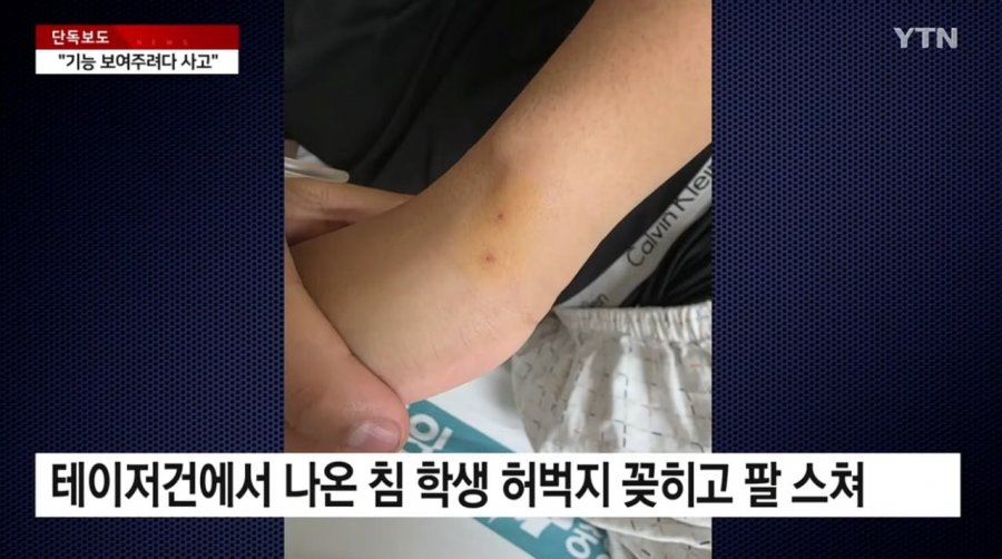 채널a) 경찰, 테이저건 보여주다 오발..중학생 다쳐