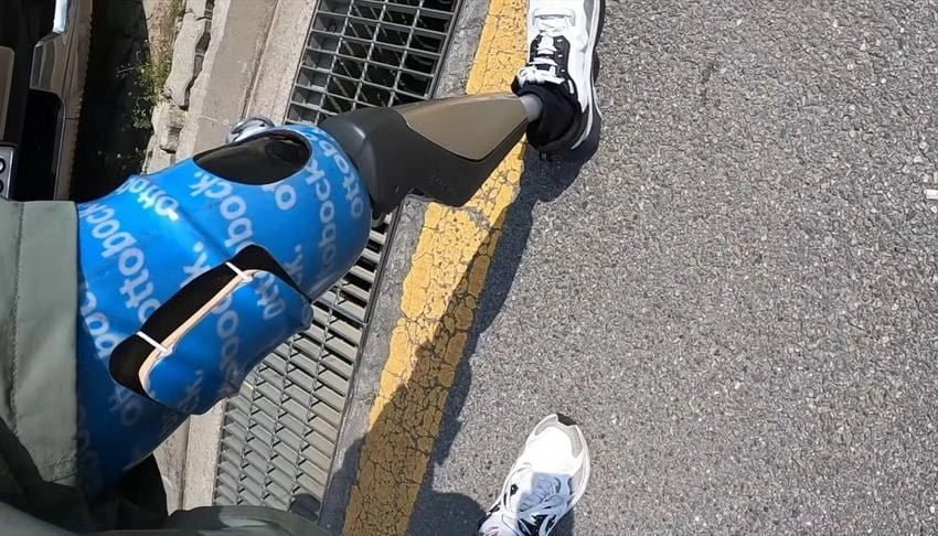 다리를 절단했는데 민방위 통지서가 날아왔다.
