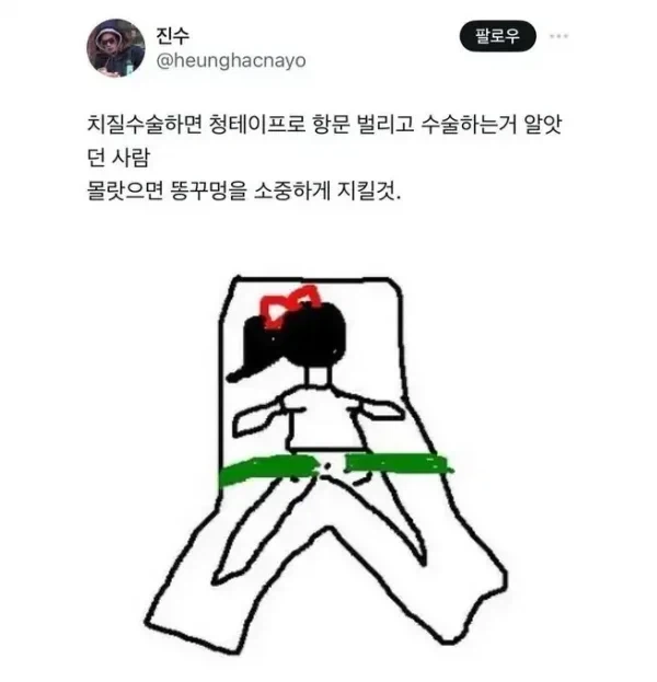 치질 수술할때 해야 한다는 자세