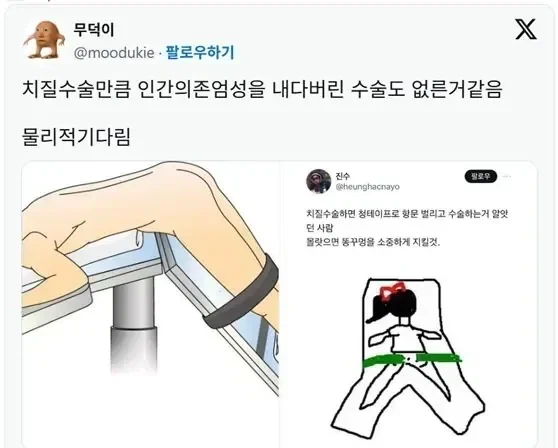 치질 수술할때 해야 한다는 자세