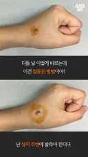 빨간약 바르는 방법을 설명해주는 약사