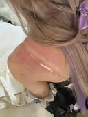 여름 야외 코스프레의 문제점