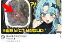 인방) 머릿속에 돌이 발견된 스트리머