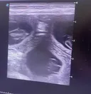 (제목 수정)우리집에 경사났음