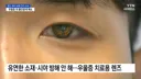 '우울증 치료용 렌즈 개발'