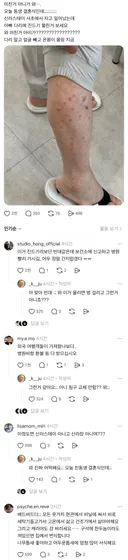 (쓰레드) 신라스테이 서초에서 자고 일어났는데 아빠 다리가