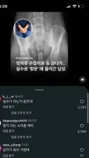 함부로 등 긁으면 안되는 이유.jpg