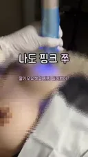 약후 )) 인스타에 이게 가능하네..딸기우유색 찌찌 시술