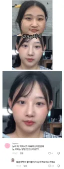 20kg 차이_ 얼굴사진