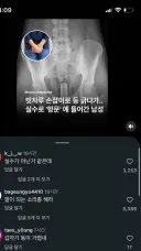 빗자루 손잡이로 등 긁으면 좋은 이유...webp