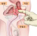 반드시 유게 베스트 가는 3가지 이슈