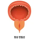 왜 일부 사람은 전립선 자극으로 가버릴까?