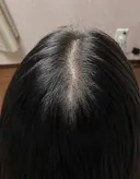 머리숱 줄기 전에 알았으면 좋았을 것들 총정리