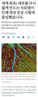 세계 첫 역노화 시험이자 시신경 재생 시험 시작