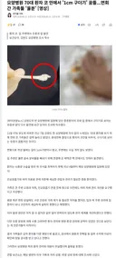 요양병원 70대 환자 코 안에서 '1cm 구더기' 꿈틀
