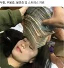 두통, 우울증, 불면증 및 스트레스 치료