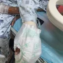 산재로 손가락을 잃은 사람들에게 마지막 희망