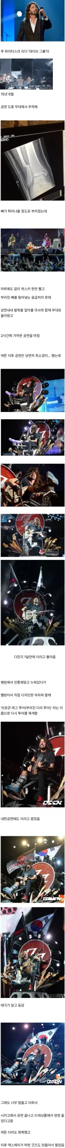 공연 중 추락해 다리가 박살난 가수