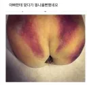아빠한테 맞다가 똥쌀뻔 함
