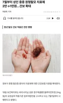 7월부터 성인 중증 원형탈모 치료제 2만→1만원…건강보험 확대 적용