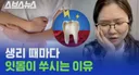 의외의 월경 관련 증상