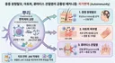 유전성 탈모치료 건보 적용 아님!!!!!!!!!!