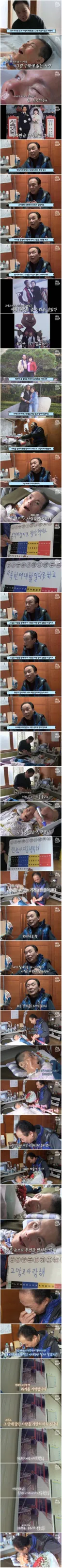 몸이 굳어가는 아내를 11년째 지키는 남편