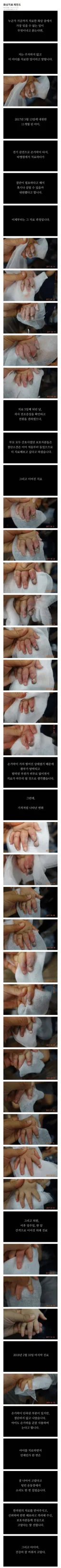 감동감동 한의원 화상치료 레전드 ㄷㄷ