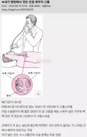 병원에서 겪은 인생 최악의 고통 TOP 1.jpg