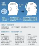 성형기술의 발전