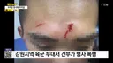 부대 부적응 병사에게 커피 포트 던지고 폭행한 간부
