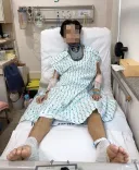 알바하다가 전신마비 된 20대 대학생