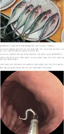 기생충 감염 위험 1위 생선.