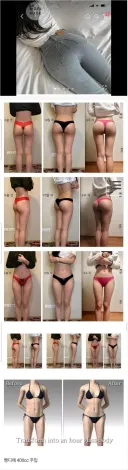 갈수록 많이하는 수술