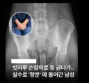 유게이들도 뭘로 등 긁을때 조심해라
