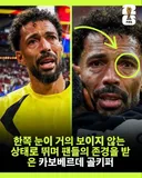 한쪽 눈이 거의 보이지 않는 상태였던 보지냐.jpg