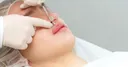 입술 필러 없애려 한 30대女, 온몸 피부 탄력 잃고 축 늘어져…진상은?