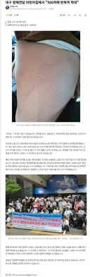 대구 장애전담 어린이집에서 500차례 반복적 학대