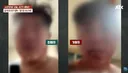 친구 얼굴 물어뜯고 살해하며