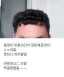 공짜 파마의 위험성