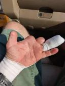 ???: 어우 일하다가 손꾸락 다침ㅠㅠ