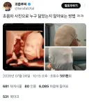 초음파 사진 누구 닮았는지 알아보는 방법